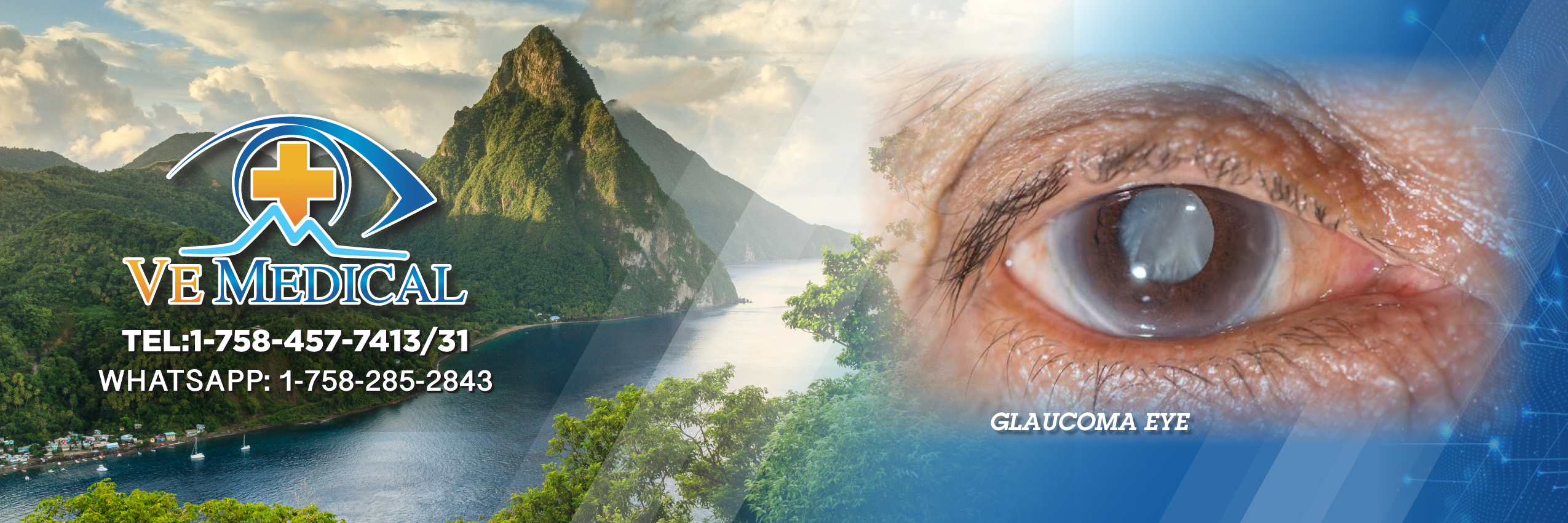 website-template-fo-ve-med-banner-Glaucoma-eye